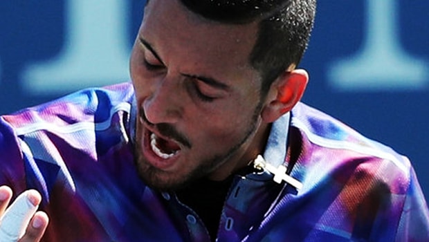 Nick-Kyrgios-US-Open-2017